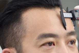 Những vấn đề y tế cần tuân thủ khi phun xăm thẩm mỹ